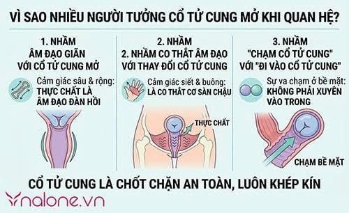 Khi quan hệ cổ tử cung có mở không?