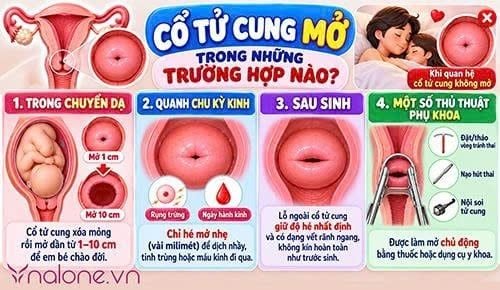 Khi quan hệ cổ tử cung có mở không?