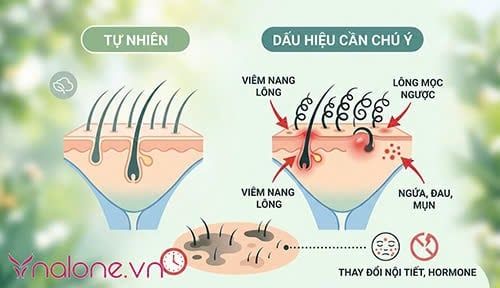 Lông vùng kín cứng và xoăn có sao không?