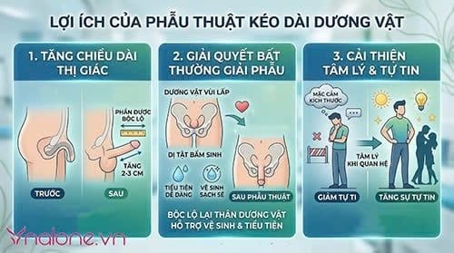 Nam giới phẫu thuật kéo dài cậu nhỏ tối đa bao nhiêu cm?
