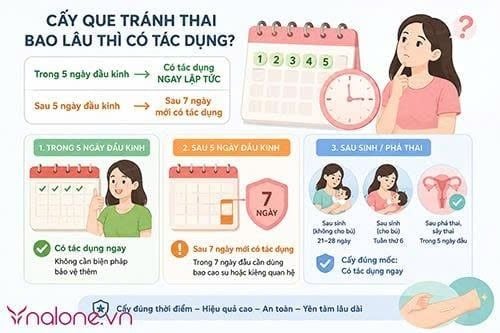 Thắc mắc cấy que tránh thai bao lâu thì có tác dụng?