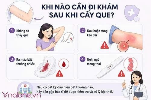 Thắc mắc cấy que tránh thai bao lâu thì có tác dụng?