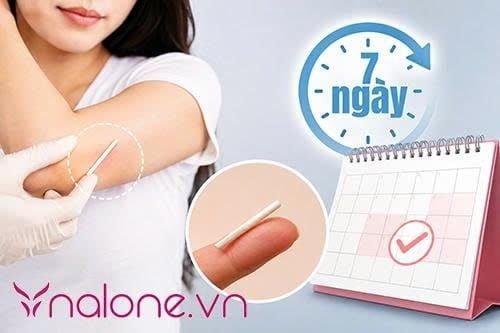 Thắc mắc cấy que tránh thai bao lâu thì có tác dụng?