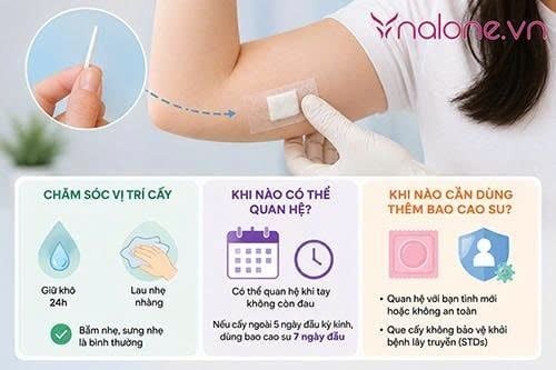 Thắc mắc cấy que tránh thai bao lâu thì có tác dụng?
