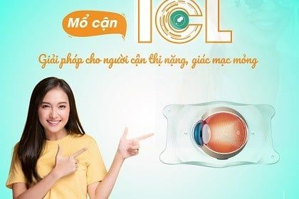 Ai phù hợp ICL? Giải pháp cho người cận thị nặng, giác mạc mỏng