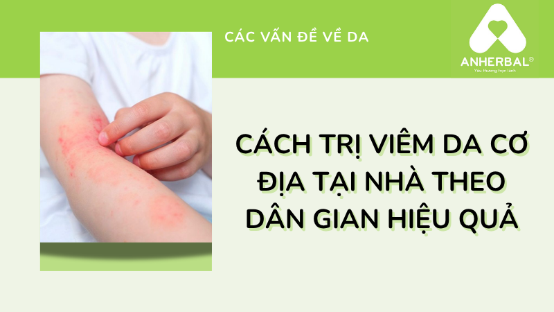 Cách trị viêm da cơ địa tại nhà theo dân gian hiệu quả
