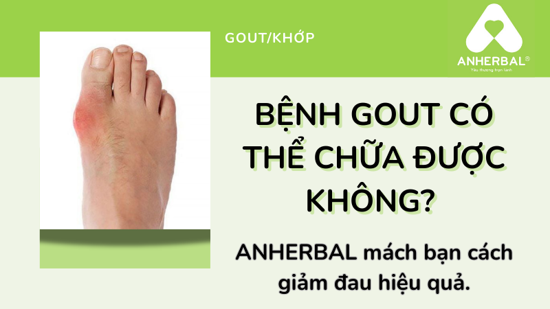 Bệnh gout có thể chữa được không? ANHERBAL giúp bạn giảm đau hiệu quả.