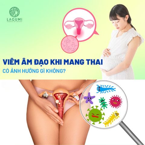 Viêm Âm Đạo Khi Mang Thai Có Nguy Hiểm Không? Nguyên Nhân – Dấu Hiệu – Cách Phòng Ngừa
