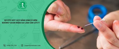 Sơ cứu đột quỵ bằng kim có nên không? Quan niệm sai lầm cần lưu ý