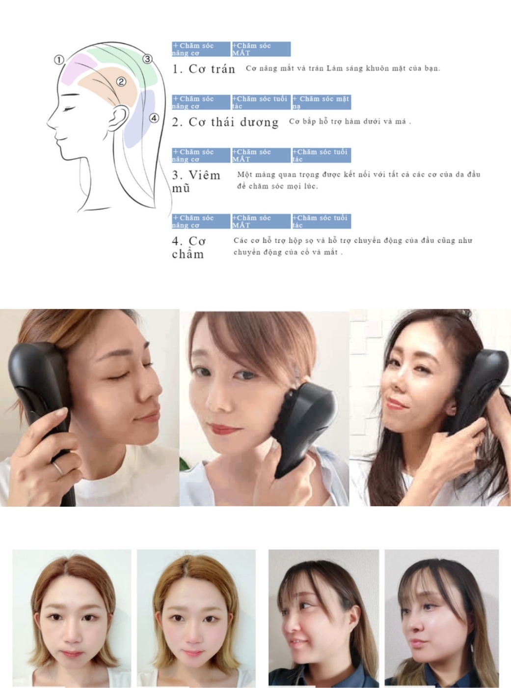Lược massage đầu Mytrex Vido Tối đa hóa hiệu quả bằng cách điều trị các khu vực phù hợp với mục tiêu của bạn.