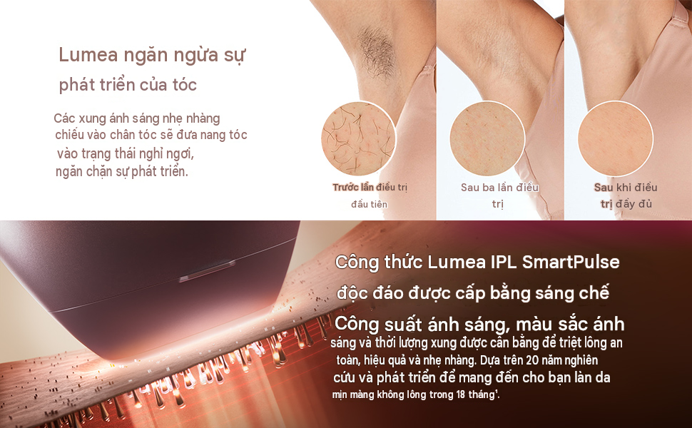 Máy triệt lông Philips Lumea IPL Series 8000 BRI945/00 với 2 đầu triệt (Face & Body)&nbsp;với công nghệ SenseIQ có hai đầu gắn thông minh dành cho cơ thể và mặt