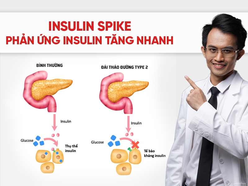 Insulin spike là gì? Tại sao đường huyết tăng đột ngột lại nguy hiểm?