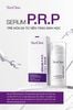 [THÔNG BÁO] DIỆN MẠO MỚI – TẦM CAO MỚI: SERUM P.R.P CHÍNH THỨC NÂNG CẤP BAO BÌ & ĐIỀU CHỈNH GIÁ BÁN