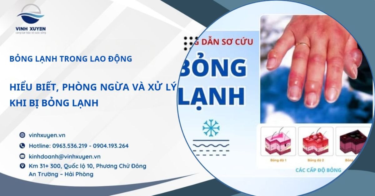 Bỏng Lạnh Trong Lao Động: Hiểu Biết, Phòng Ngừa Và Xử Lý