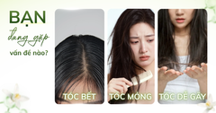 TÓC BẾT - TÓC MỎNG - TÓC DỄ GÃY: BẠN ĐANG GẶP VẤN ĐỀ NÀO?