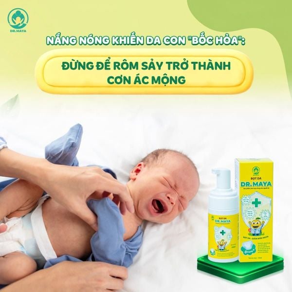 CÁCH CHĂM SÓC DA BÉ BỊ MẨN ĐỎ, HĂM DA, RÔM SẢY TRONG MÙA NÓNG