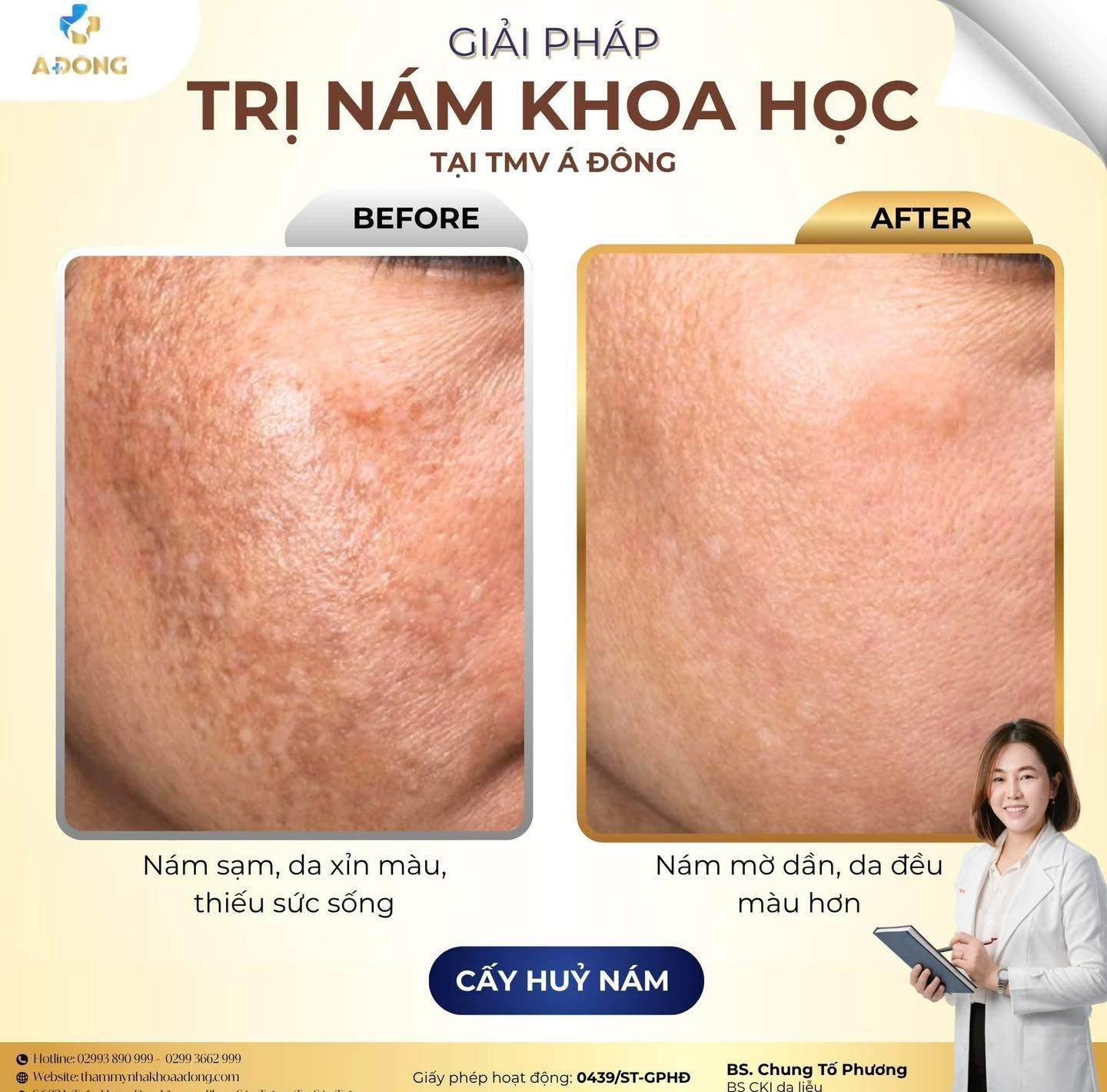 NÁM KHÔNG CHỈ DO TUỔI TÁC – MÀ ĐẾN TỪ CHÍNH THÓI QUEN HẰNG NGÀY