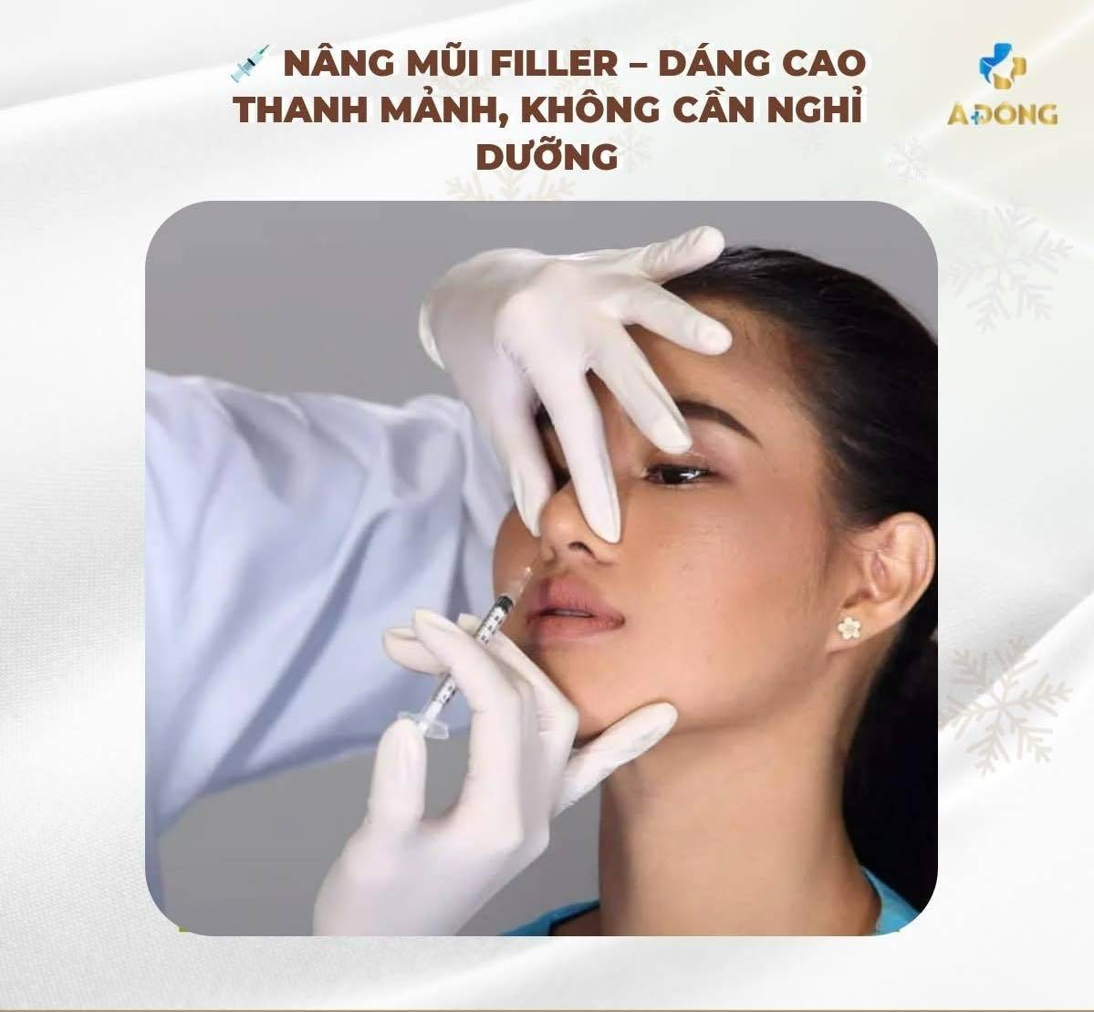 NÂNG MŨI FILLER – DÁNG CAO THANH MẢNH, KHÔNG CẦN NGHỈ DƯỠNG