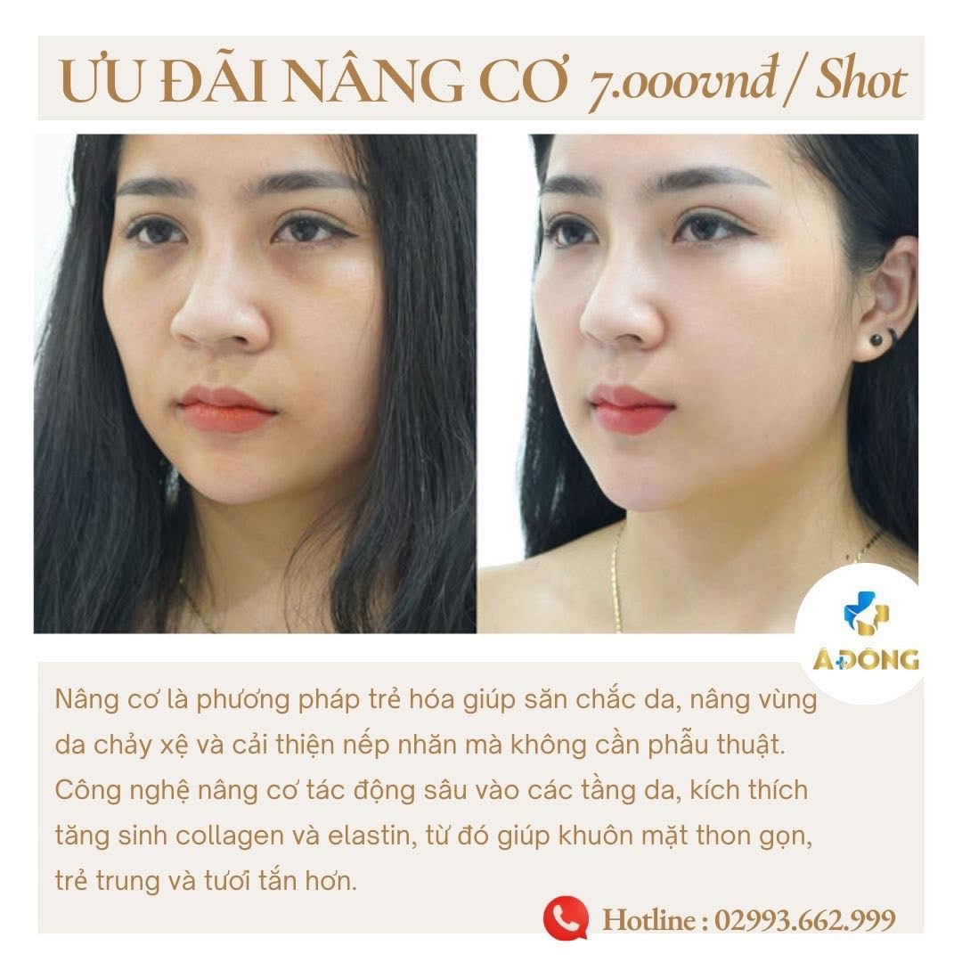 💆‍♀️ Nâng cơ – trẻ hóa da không phẫu thuật chỉ với 7.000vnđ/ Shot