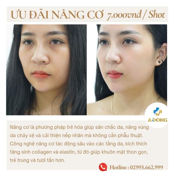 💆‍♀️ Nâng cơ – trẻ hóa da không phẫu thuật chỉ với 7.000vnđ/ Shot