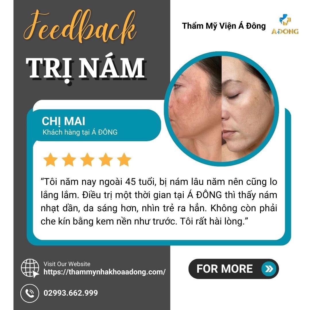 🌸 KHÁCH HÀNG SAU KHI TRỊ NÁM TẠI Á ĐÔNG CHIA SẺ THẾ NÀO? 🌸