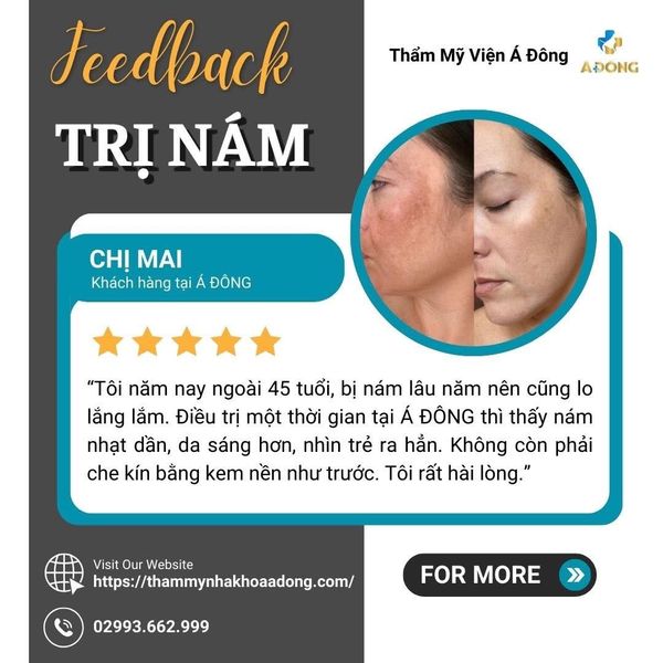 🌸 KHÁCH HÀNG SAU KHI TRỊ NÁM TẠI Á ĐÔNG CHIA SẺ THẾ NÀO? 🌸