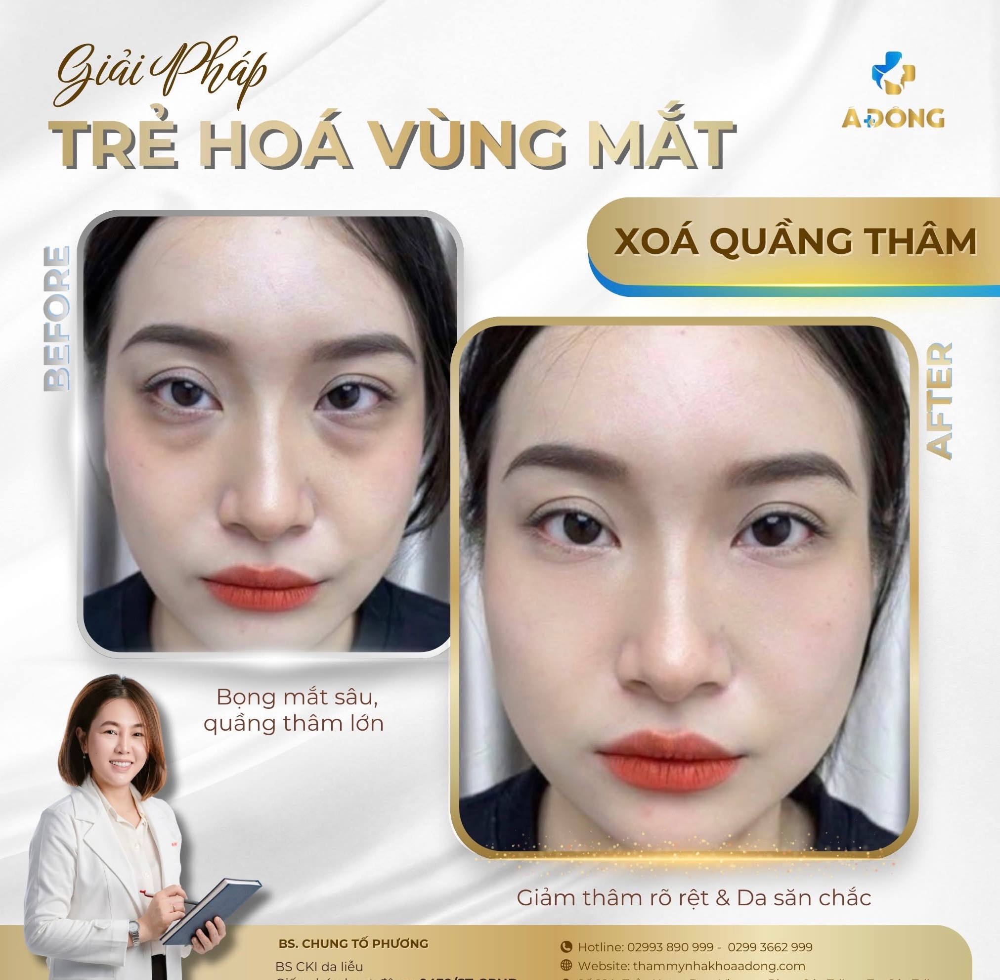 👁 Đôi mắt không chỉ mệt – mà đang kêu cứu