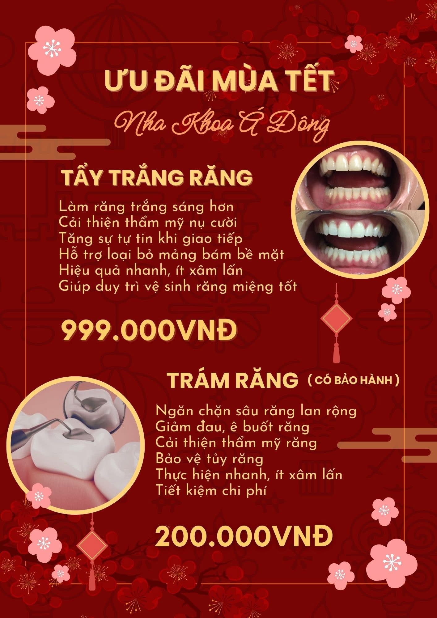 🎉 ƯU ĐÃI TẾT – CHĂM SÓC RĂNG XINH, TỰ TIN ĐÓN NĂM MỚI 🎉