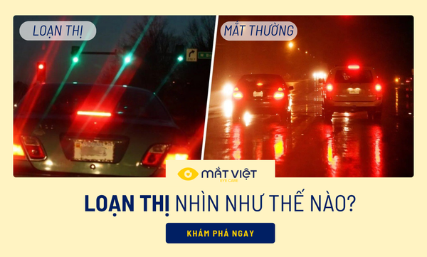 Loạn thị nhìn như thế nào? Dấu hiệu nhận biết qua góc nhìn thực tế