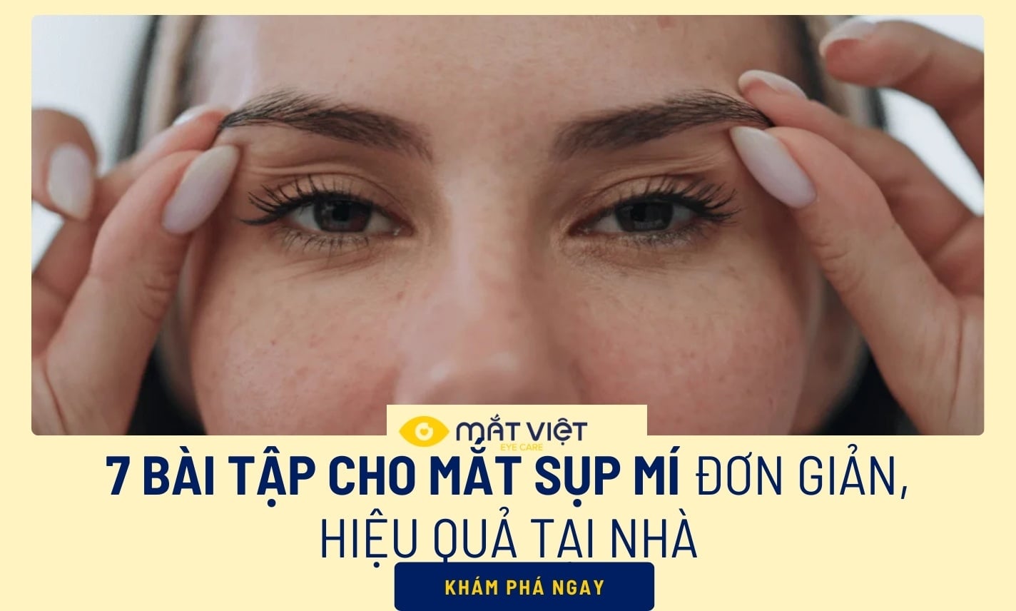7 bài tập cho mắt sụp mí đơn giản, hiệu quả tại nhà
