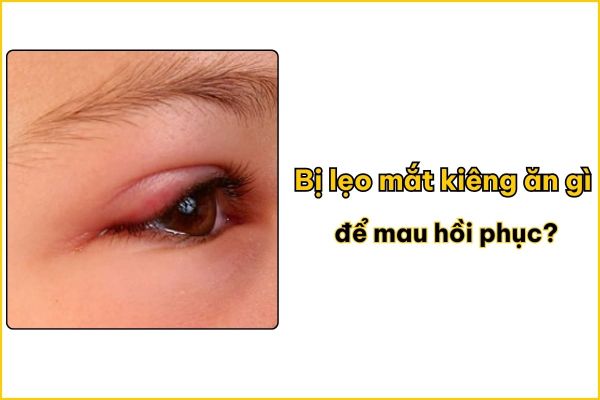 Bị lẹo mắt kiêng ăn gì để mau hồi phục?