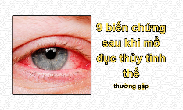 9 biến chứng sau khi mổ đục thủy tinh thể thường gặp