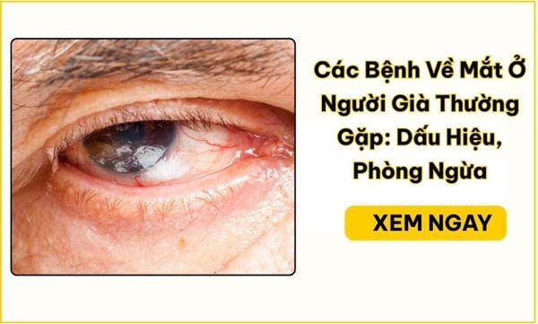 Các bệnh về mắt ở người già: Dấu hiệu và cách phòng ngừa