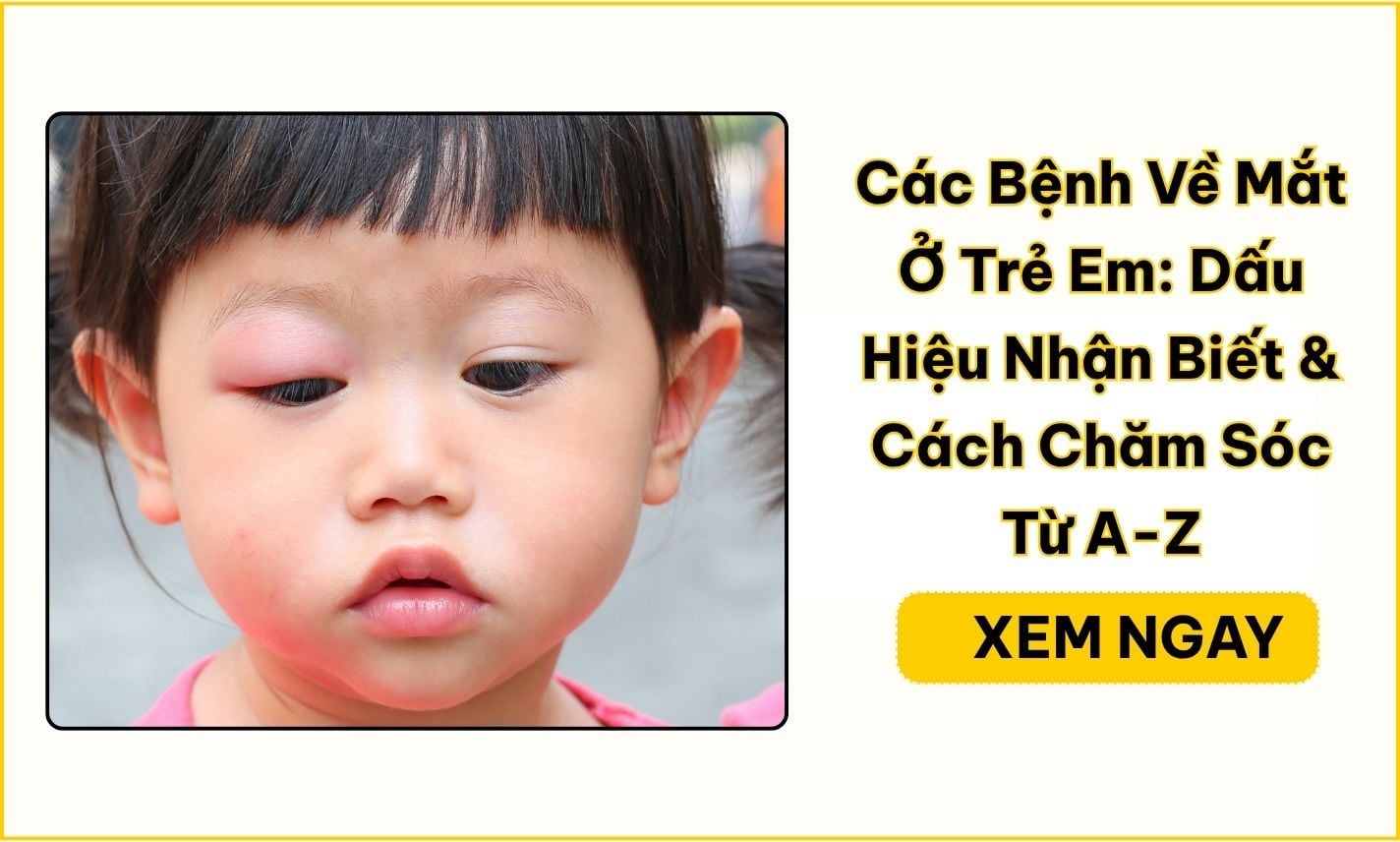 Các bệnh về mắt ở trẻ em: Dấu hiệu và khi nào cần khám