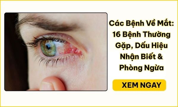 Các bệnh về mắt: 16 bệnh, tật thường gặp và dấu hiệu