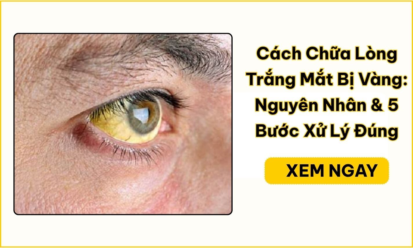 Cách chữa lòng trắng mắt bị vàng: 5 bước xử lý đúng