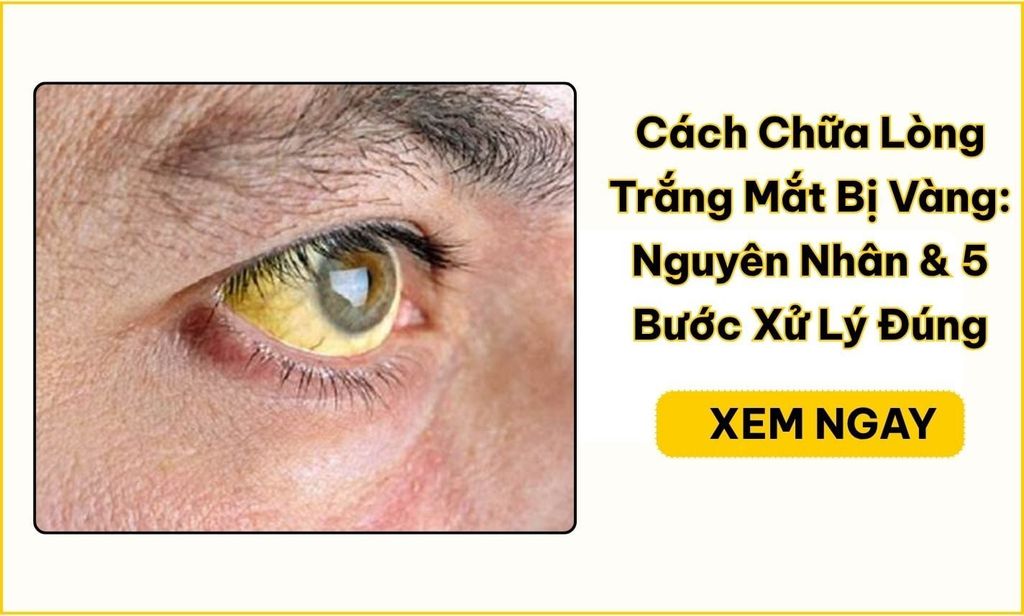 Cách Chữa Lòng Trắng Mắt Bị Vàng: Nguyên Nhân & 5 Bước Xử Lý Đúng