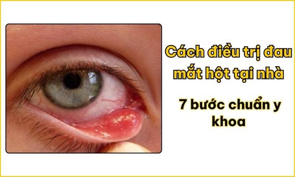 Cách điều trị đau mắt hột tại nhà: 7 bước chuẩn y khoa