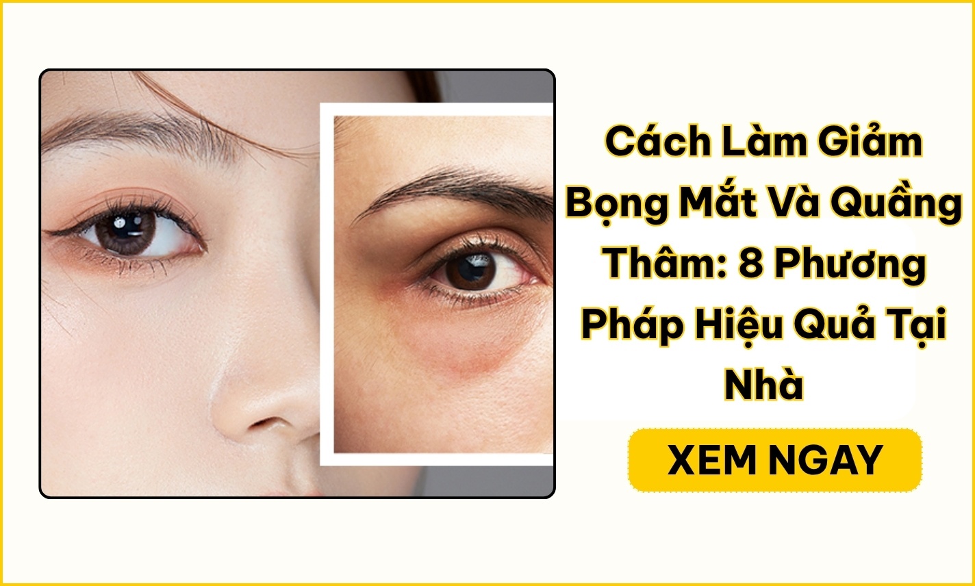 Cách làm giảm bọng mắt và quầng thâm an toàn tại nhà