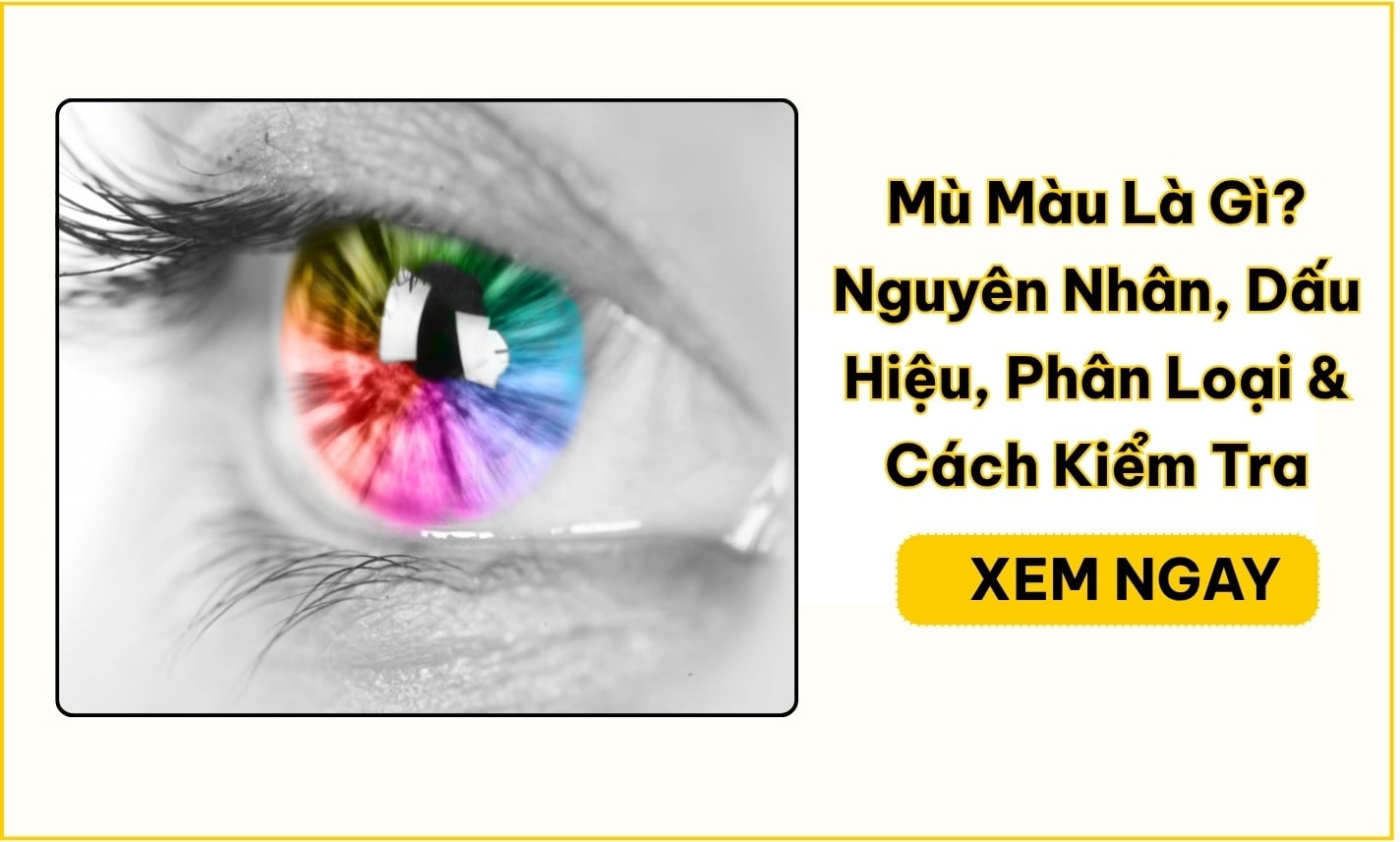 Mù Màu Là Gì? Nguyên Nhân, Dấu Hiệu, Phân Loại & Cách Kiểm Tra
