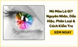 Mù Màu Là Gì? Nguyên Nhân, Dấu Hiệu, Phân Loại & Cách Kiểm Tra