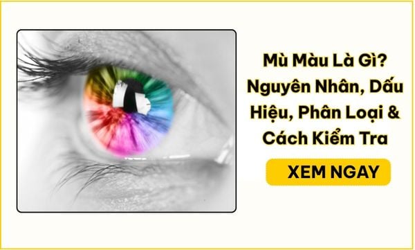 Mù Màu Là Gì? Nguyên Nhân, Dấu Hiệu, Phân Loại & Cách Kiểm Tra