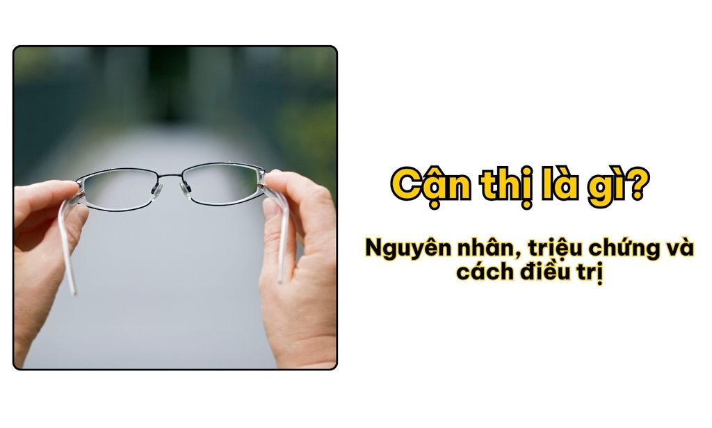 Cận thị là gì? Nguyên nhân, triệu chứng và cách điều trị