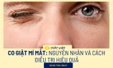 Co giật mí mắt: Nguyên nhân và cách điều trị hiệu quả