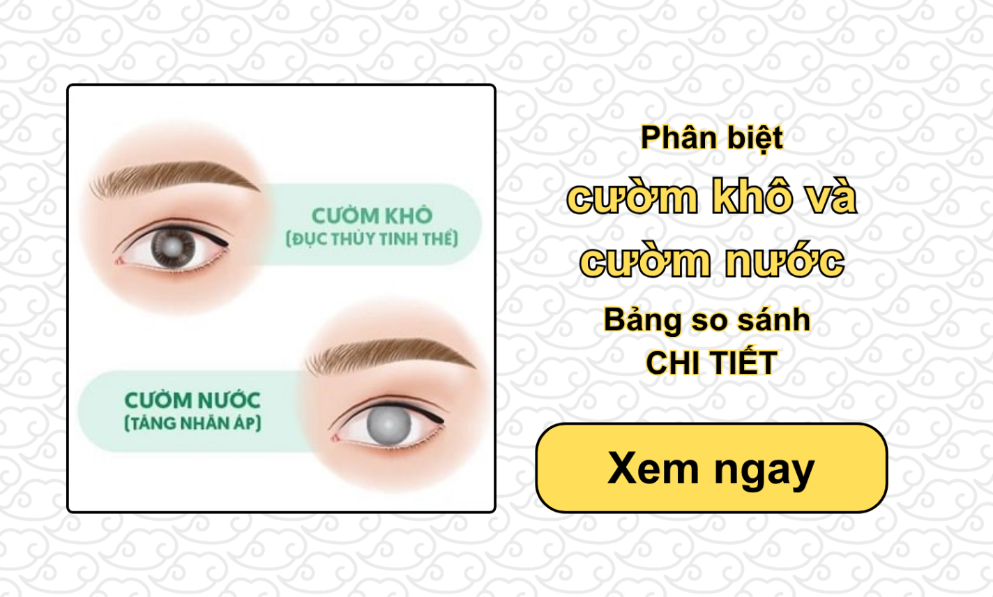 Phân biệt cườm khô và cườm nước: Bảng so sánh CHI TIẾT