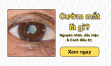 Cườm mắt là gì? Nguyên nhân, dấu hiệu & Cách điều trị