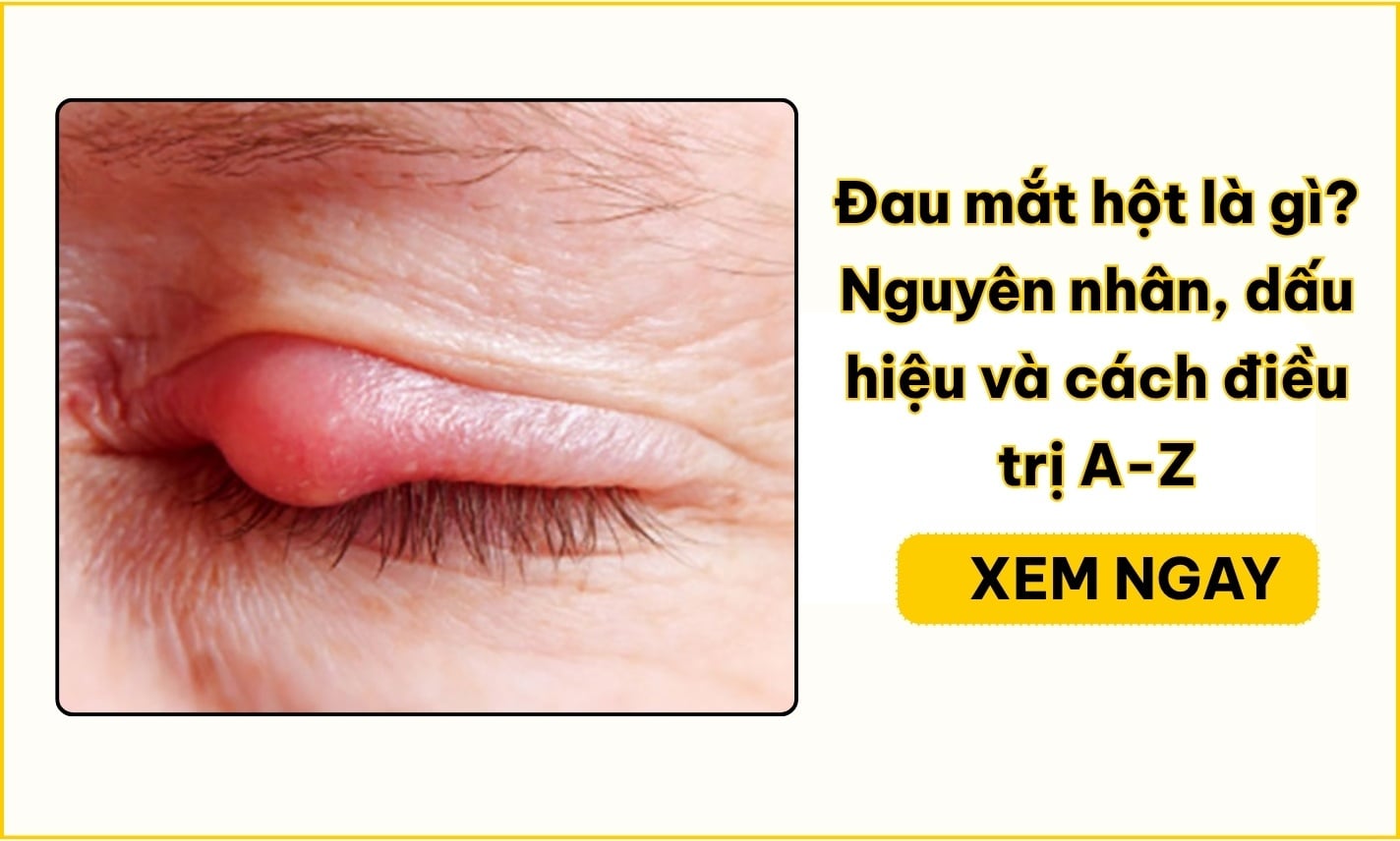 Đau mắt hột là gì? Nguyên nhân, dấu hiệu và cách điều trị A-Z