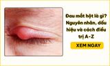 Đau mắt hột là gì? Nguyên nhân, dấu hiệu và cách điều trị A-Z