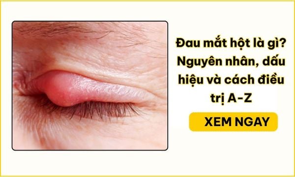 Đau mắt hột là gì? Nguyên nhân, dấu hiệu và cách điều trị A-Z