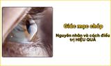 Giác mạc chóp: Nguyên nhân và cách điều trị HIỆU QUẢ